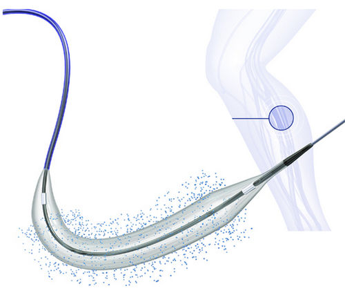 Catéter ATP - BIOPATH™ 014 - Biosensors International - periférico / arterial / arteria femoral