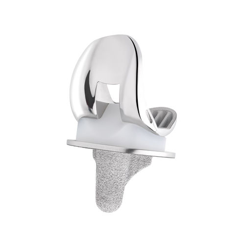 Prótesis de rodilla tricompartimental - MC2® - C2F Implants - de revisión / de deslizamiento con estabilización posterior / de platillo móvil