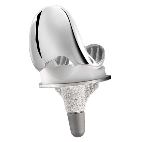 Prótesis de rodilla tricompartimental - MC2® UC - C2F Implants - de platillo móvil
