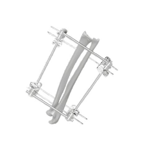 Fijador externo para tibia - 201551 - SOFEMED International - para peroné / tubular / para adulto