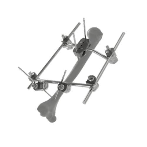 Fijador externo para húmero - 206305 - SOFEMED International - tubular / para adulto