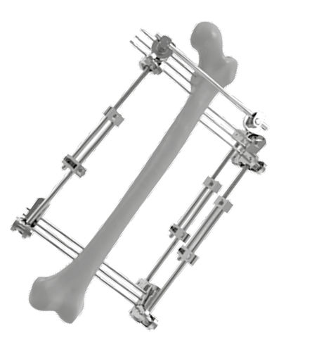 Fijador externo para fémur - 201501 - SOFEMED International - tubular / para adulto