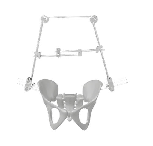 Fijador externo de pelvis - 201561 - SOFEMED International - tubular / para adulto