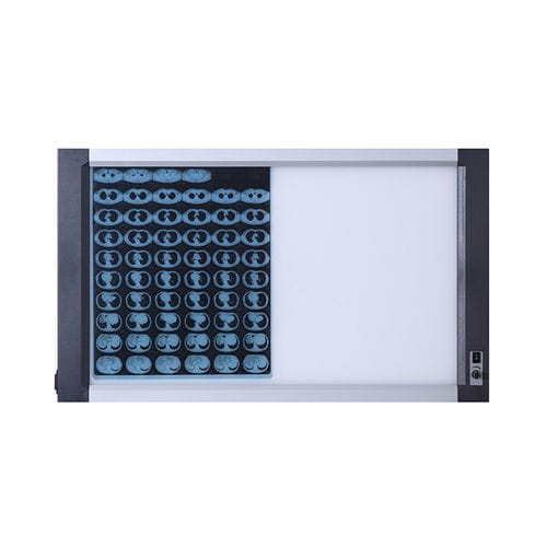 Negatoscopio 2 pantallas - Jiangsu Dengguan Medical Treatment Instrument - LED