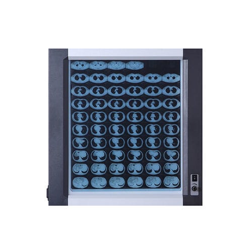 Negatoscopio 1 pantalla - Jiangsu Dengguan Medical Treatment Instrument - LED