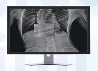 Software de radiología - MADXVIEW - Medonica - de visualización / para tablet PC