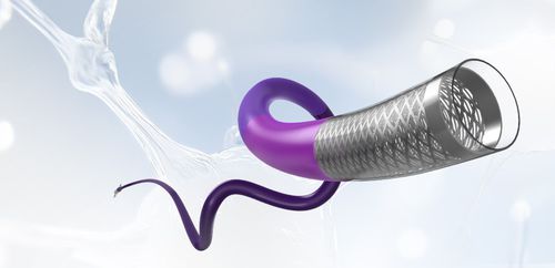 Catéter de aspiración - Speedpass88™ - Medprin Biotech - neurovascular