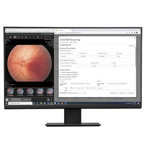 Software de gestión de datos - DataLink  - Natus Medical - de diagnóstico / para informes / de intercambio de datos