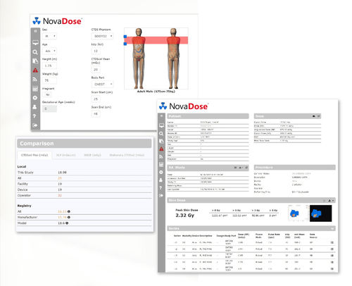 Software de gestión de las dosis absorbidas - NovaDose®  - Novarad - clínico / TDM / para IRM