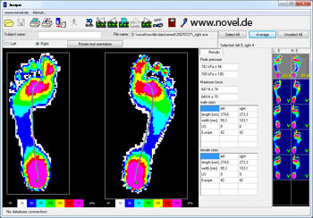 Software para podología - novel footpat®  - novel - de análisis