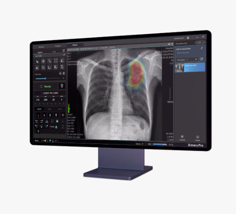 Software médico - Xmaru Pro - Rayence - de radiografía / de gestión de datos / visualizador