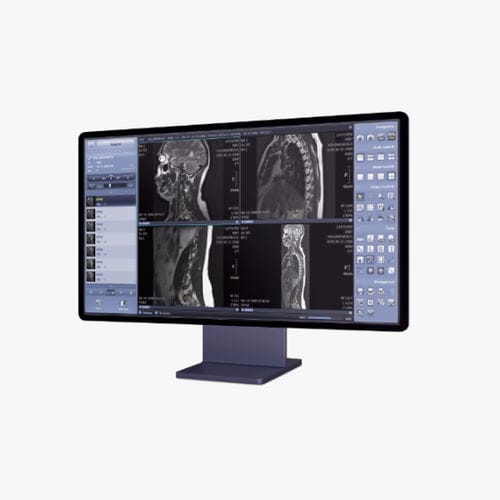 PACS para imágenes médicas - Xmaru  - Rayence
