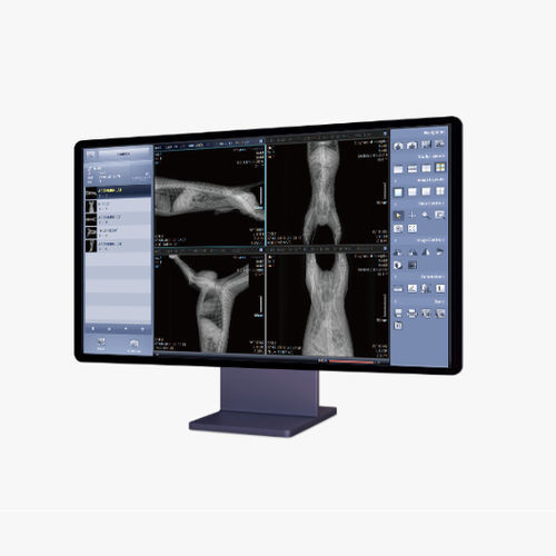 PACS para imágenes médicas - VXV - Rayence