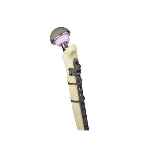 Placa de compresión para fractura femoral periprotésica - Sirtalis  - Sanatmetal - porción proximal / bloqueada / no bloqueada