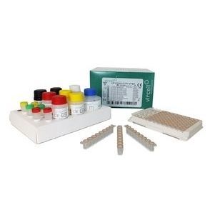 Kit de prueba para enfermermedades infecciosas - G/M1004 - Vircell - globulina / de IgG / de IgM
