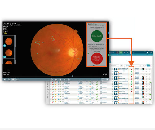 Software para oftalmología - OphtAI - EVOLUCARE - de gestión / de diagnóstico / detección de la retinopatía diabética