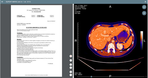 Software visualizador - Uview - EVOLUCARE - médico / de radiología / de diagnóstico