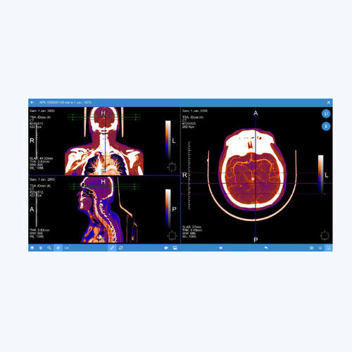 PACS para imágenes médicas - EVOLUCARE