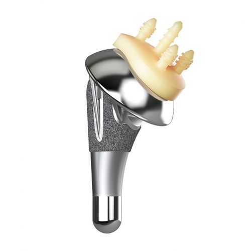 Prótesis de hombro no cementada - AltiVate® - Enovis Surgical