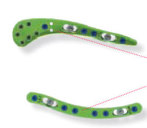 Placa de compresión para clavícula - CBTGLN1 - Newclip Technics - lateral / porción medial / bloqueada