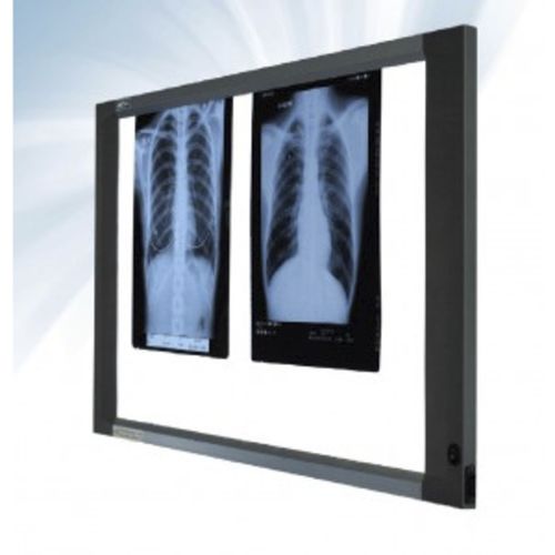 Negatoscopio 2 pantallas - Cablas - para odontología / LED