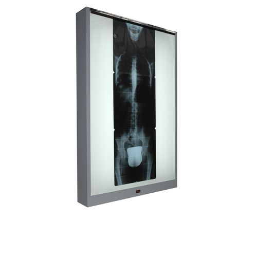 Negatoscopio 1 pantalla - M-NV-010	 - Cablas - vertical / de luz blanca