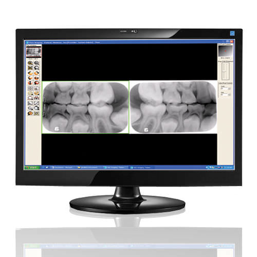 Software para imagen dental - Visix® - Air Techniques