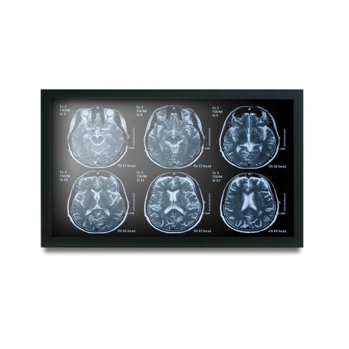 Monitor médico - MEDDP-622 - Onyx Healthcare Inc - 19" / LCD / con retroiluminación LED