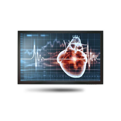 Monitor médico - MEDDP-615 - Onyx Healthcare Inc - 18,5" / LCD / con retroiluminación LED