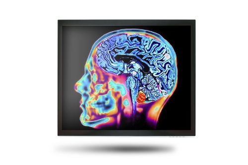 Monitor médico - MEDDP-415 - Onyx Healthcare Inc - 17" / LCD / con retroiluminación LED