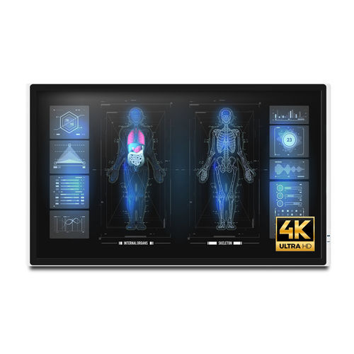 Monitor médico - MEDDP-632 - Onyx Healthcare Inc - 4K / 32" / LCD