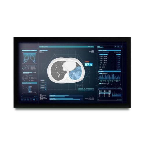 Monitor médico - MEDDP-627 - Onyx Healthcare Inc - Full HD / 1920 x 1080 / 27"