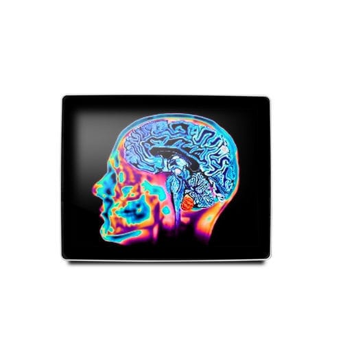 Monitor médico - MEDDP-415 - Onyx Healthcare Inc - 17" / LCD / con retroiluminación LED