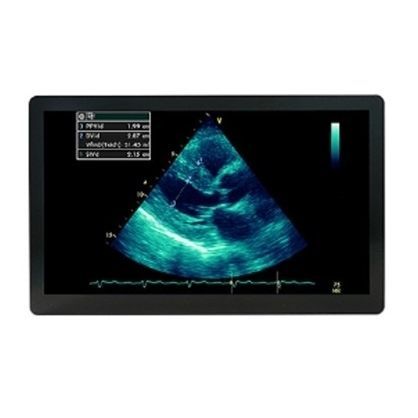 Monitor para ecografía - MSBP2416AMC - Avalue Healthcare - quirúrgico / 1920 x 1080 / 24"