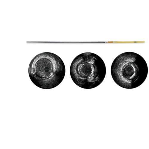 Catéter de diagnóstico - Refinity - Spectranetics - coronario / auricular izquierdo / con revestimiento hidrófilo