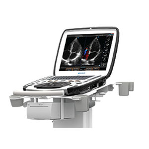 Ecógrafo portátil, con carro - uSmart® 3300 NexGen  - Terason - para ecografía con anestesia y en cuidados intensivos / para ecografía en urgencias médicas / para ecocardiografía de estrés farmacológico