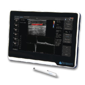 Ecógrafo portátil - uSmart® 3200T NexGen - Terason - para ecografía en urgencias médicas / para ecografía con anestesia y en cuidados intensivos / blanco y negro