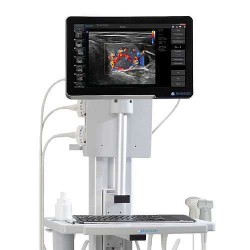 Ecógrafo portátil, con carro - uSmart® 3200T Plus - Terason - para ecografía polivalente / blanco y negro / doppler-color