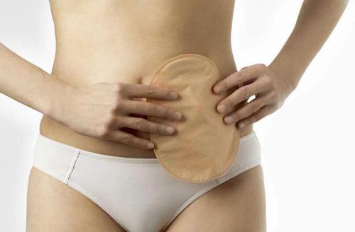Bolsa de ileostomía - SenSura®  - Coloplast