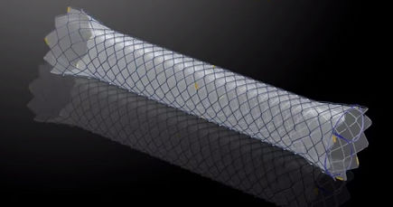 Stent colónico - HANAROSTENT®TTS (CCC) - M.I Tech - rectal