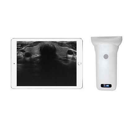 Ecógrafo de mano - Sonostar Technologies - para ecografía polivalente / blanco y negro / doppler-color