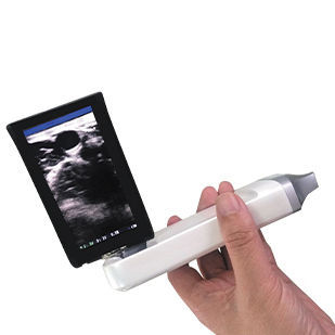 Ecógrafo de mano - XProbe - Sonostar Technologies - para ecografía polivalente / blanco y negro / sonda inalámbrica