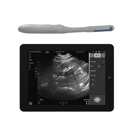 Ecógrafo de mano - CProbe-4TR  - Sonostar Technologies - para ecografía endovaginal / blanco y negro / doppler-color