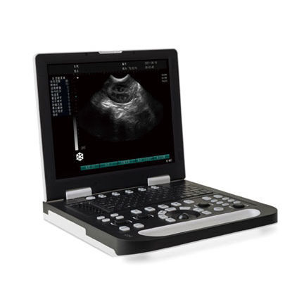 Ecógrafo portátil - SS-10 - Sonostar Technologies - para ecografía polivalente / blanco y negro / 15 pulgadas