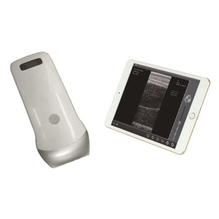 Ecógrafo veterinario de mano - UProbe-2B - Sonostar Technologies - multifuncional / para felinos / sonda inalámbrica