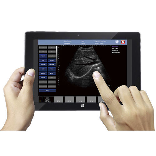 Ecógrafo veterinario portátil - V10 - Sonostar Technologies - multifuncional / para porcinos