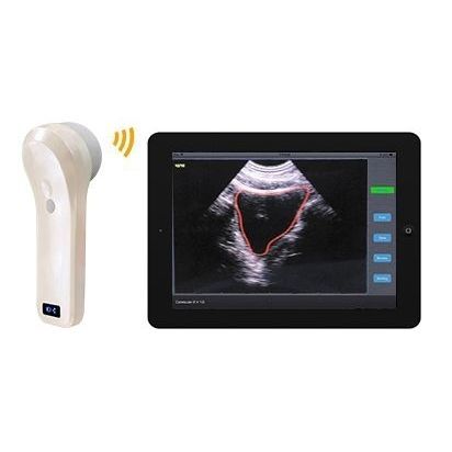 Escáner de vejiga portátil - BProbe-2 - Sonostar Technologies