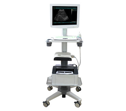 Ecógrafo con soporte, compacto - SS-100 Touch Screen Trolley Ultrasound Diagnosis B - Sonostar Technologies - para ecografía polivalente / doppler-color