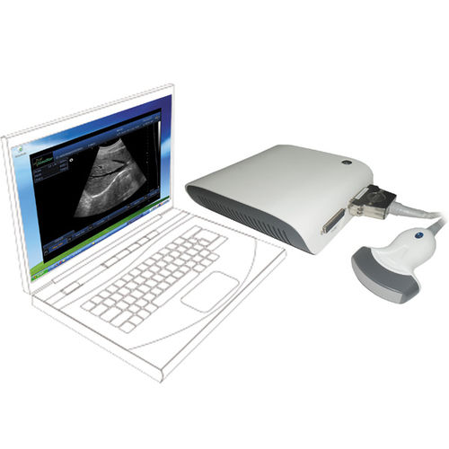 Ecógrafo en plataforma, de mesa - UBox-10 - Sonostar Technologies - para ecografía polivalente / blanco y negro / convexo