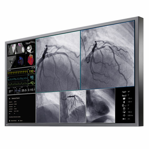 Monitor para sala de operaciones - CuratOR® LX550W - EIZO GmbH - para imágenes médicas / 4K / 55"